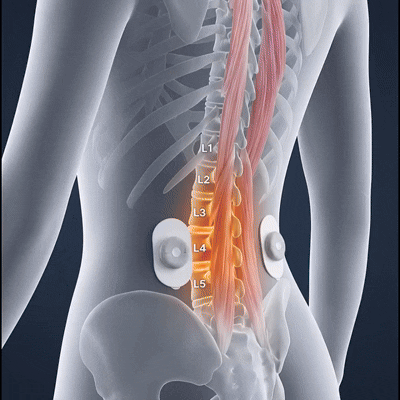 3. Meet the At-Home Device That Works Like a TENS Unit and a Massage Gun in One